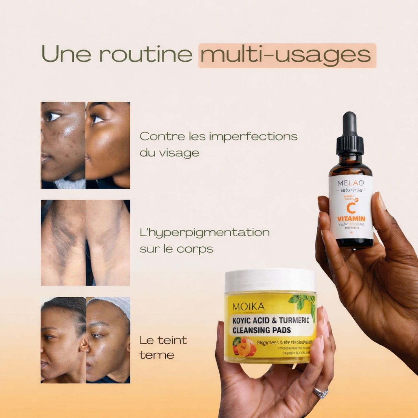 Routine Anti-Imperfections