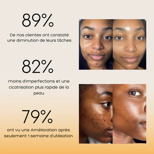 Routine Anti-Imperfections