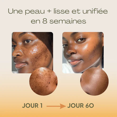 Routine Anti-Imperfections